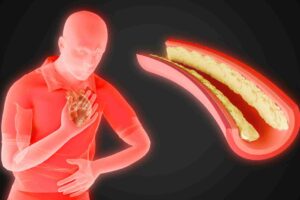 unhealthy ill